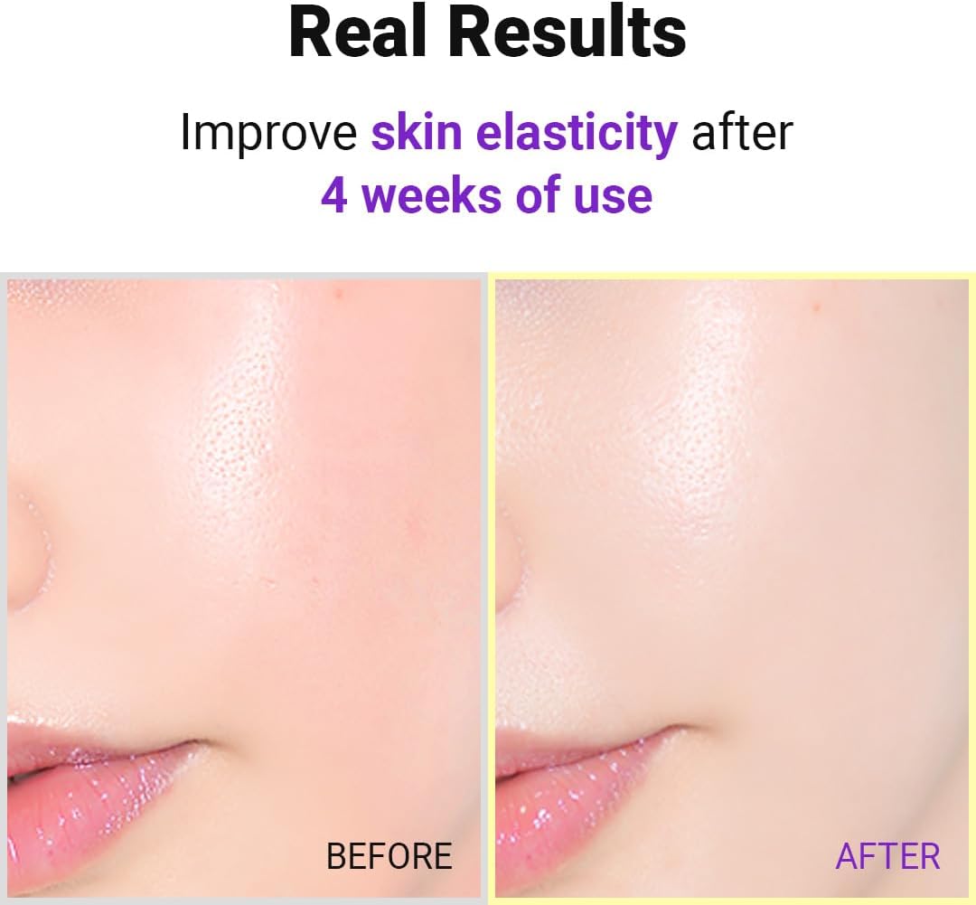 Isntree Hyper Retinol EX 1.0 Serum 20Ml